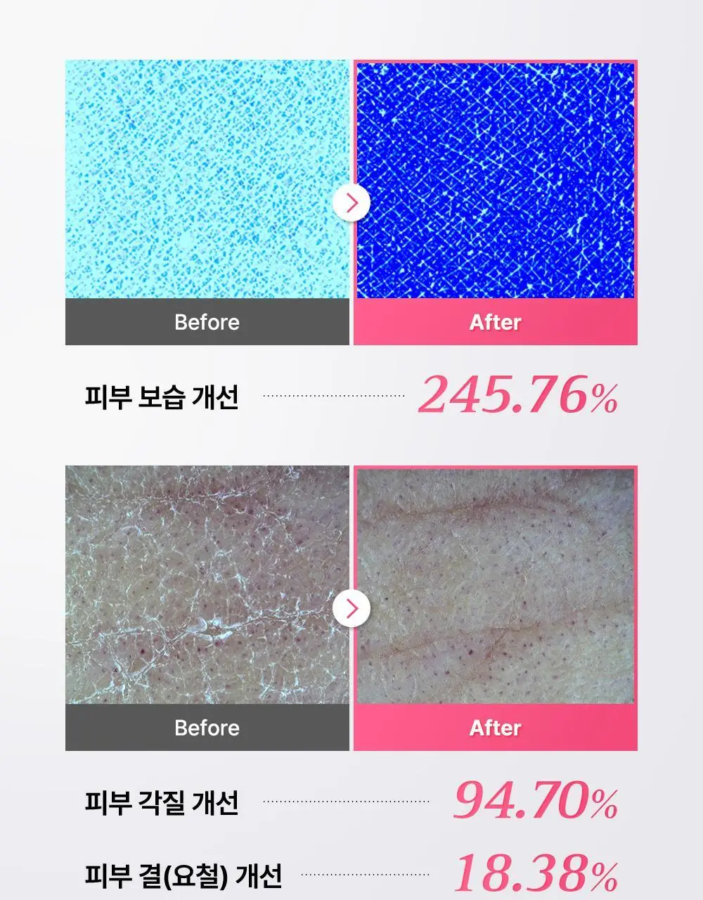 [리뉴얼/원조패드]코스알엑스 원스텝 패드 100매 4종 중 택1 상세페이지 100